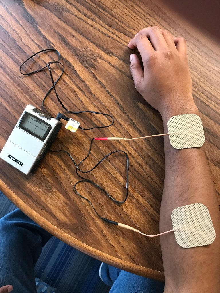 E-Stim and Muscle